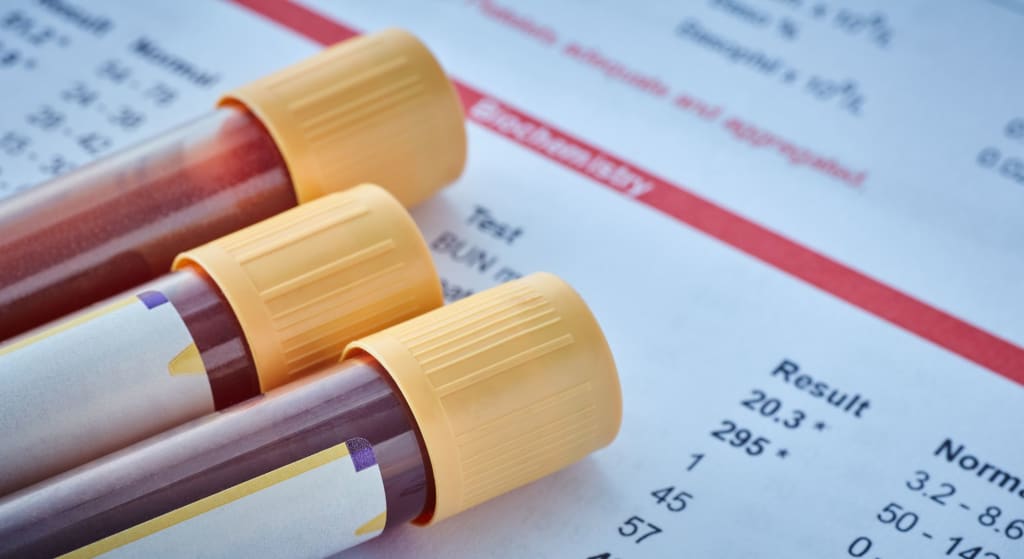 Three blood sample vials with yellow caps are placed on top of a printed blood test results sheet displaying various medical data, including lipoprotein a test results.